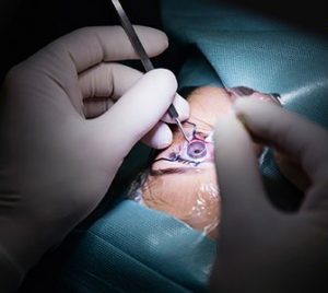 Benefits of using liquid silicone rubber for ophthalmology devices