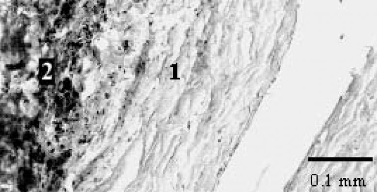 Biocompatibility of Liquid Silicone Rubber (LSR)